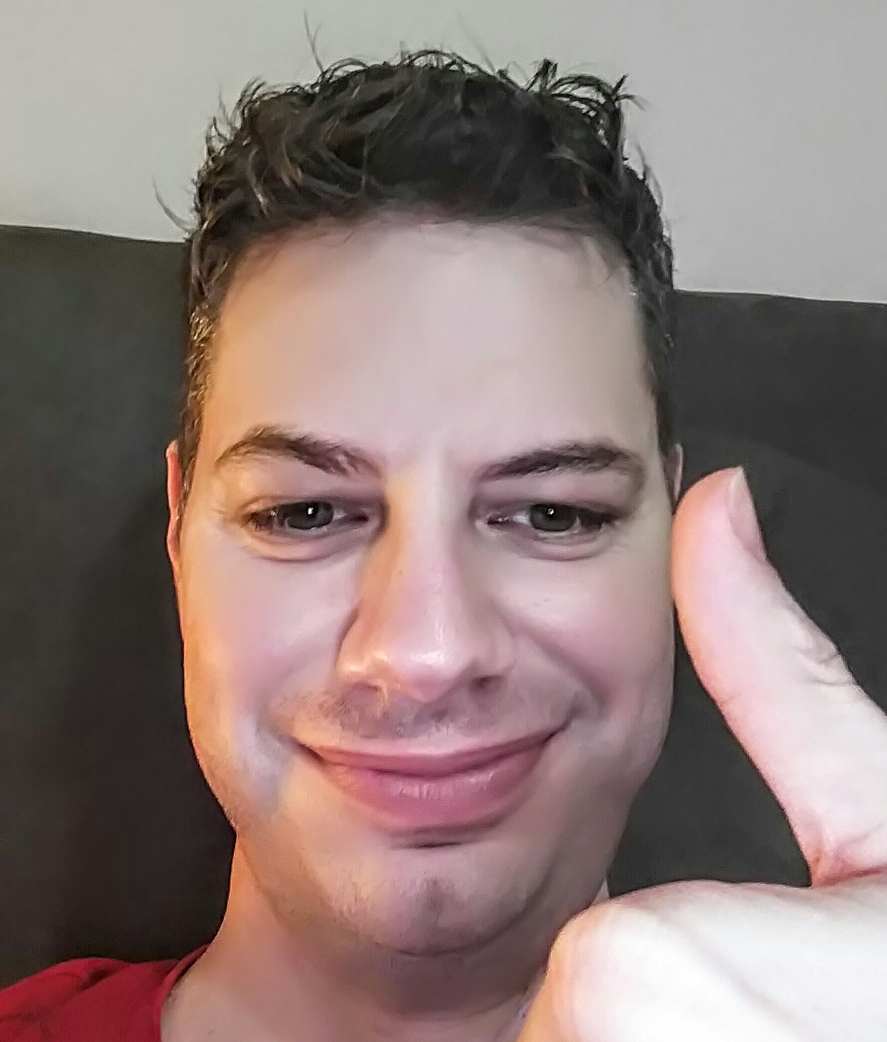 Oct 20 – Radiation starts